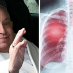 Vatican Updates on Pope Francis’ Health as He Battles Double Pneumonia