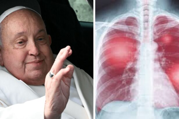 Vatican Updates on Pope Francis’ Health as He Battles Double Pneumonia