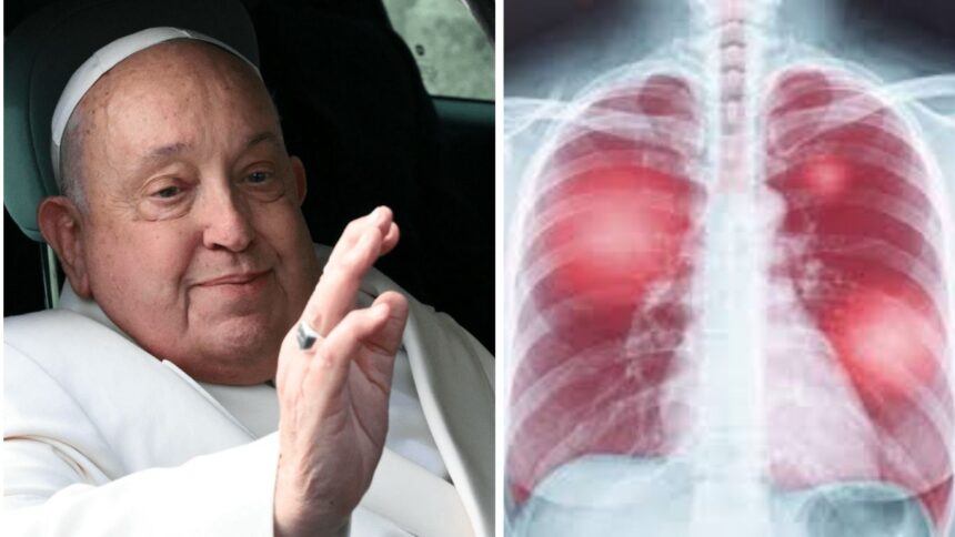 Vatican Updates on Pope Francis’ Health as He Battles Double Pneumonia